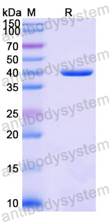 Recombinant Human GFRAL Protein, N-His