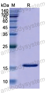 Recombinant Human LRRFIP1 Protein, N-His