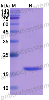 Recombinant Human LGALS9B Protein, N-His