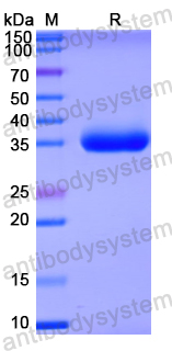 Recombinant Human VPS26B Protein, N-His