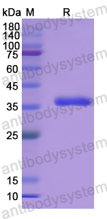 Recombinant Human ERFE Protein, N-His