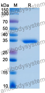 Recombinant Human SEZ6 Protein, N-His