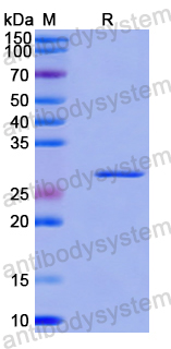 Recombinant Human GPAT3 Protein, N-His