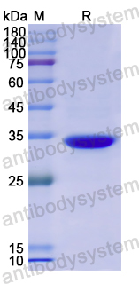 Recombinant Human CEP55 Protein, N-His