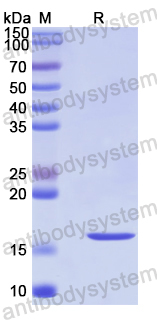 Recombinant Human PLEKHO1 Protein, N-His