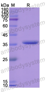 Recombinant Human HSD17B12 Protein, N-His