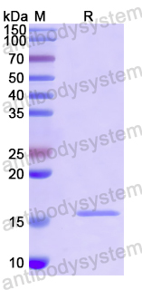 Recombinant Human ODF2 Protein, N-His
