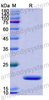 Recombinant Human ZC3H12A Protein, N-His
