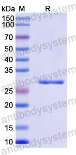 Recombinant Human ZRANB3 Protein, N-His