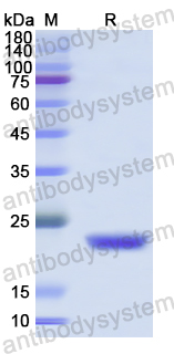 Recombinant Human RNASE10 Protein, N-His