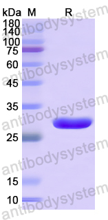 Recombinant Human VWA2 Protein, N-His