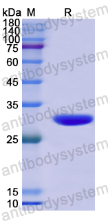 Recombinant Human PITRM1 Protein, N-His