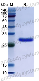 Recombinant Human EPHA10 Protein, N-His