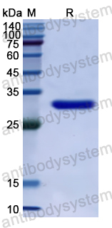 Recombinant Human LRRK2 Protein, N-His