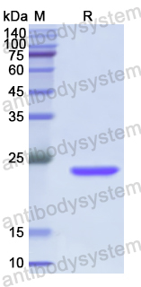 Recombinant Human ATAT1 Protein, C-His