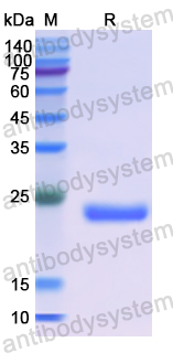 Recombinant Human ATAT1 Protein, N-His