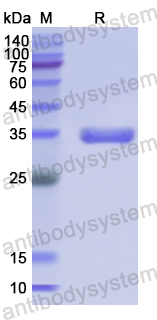 Recombinant Human SFRP5 Protein, N-His