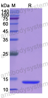 Recombinant Human UBAP2 Protein, N-His