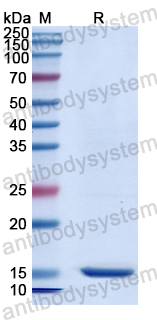 Recombinant Human DEPDC1 Protein, N-His