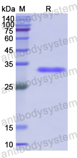 Recombinant Human TTBK1 Protein, N-His