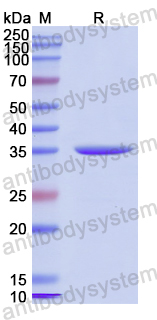 Recombinant Human MTARC1 Protein, N-His