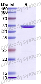 Recombinant Human ATG16L1 Protein, N-GST