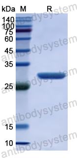 Recombinant Human WWC2 Protein, N-His