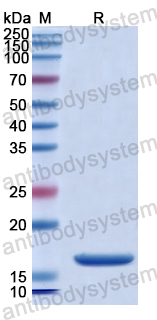 Recombinant Human LGALS9C Protein, N-His