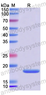 Recombinant Human IL31 Protein, N-His