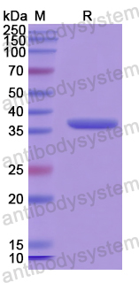 Recombinant Human VASN Protein, N-His