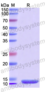 Recombinant Human SFRP4 Protein, N-His