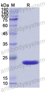 Recombinant Human ZFAND6 Protein, N-His