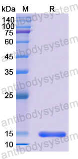 Recombinant Human SIGIRR Protein, N-His