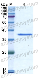 Recombinant Human LCN12 Protein, N-GST