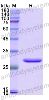 Recombinant Human ERAP2 Protein, N-His