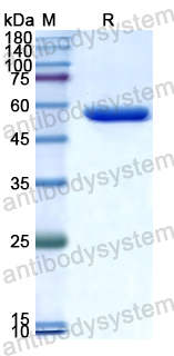 Recombinant Human LPCAT3 Protein, N-His