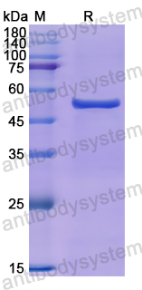 Recombinant Human PLB1 Protein, N-His
