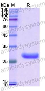 Recombinant Human SLC27A4 Protein, N-His