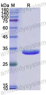 Recombinant Human CC2D1A Protein, N-His