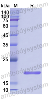 Recombinant Human ATAD2 Protein, N-His
