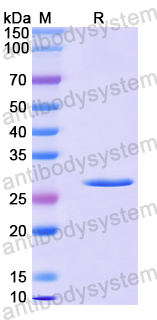 Recombinant Human ATAD2 Protein, N-His
