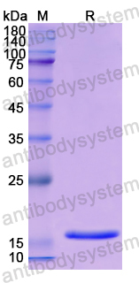 Recombinant Human CPLX2 Protein, N-His