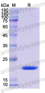 Recombinant Human APOA5 Protein, N-His