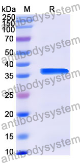 Recombinant Human CRTC1 Protein, N-GST & C-His