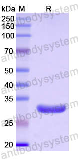 Recombinant Human ENHO Protein, N-GST
