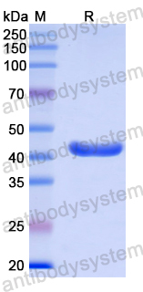 Recombinant Human LCN15 Protein, N-GST