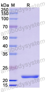 Recombinant Human CES3 Protein, N-His