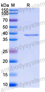 Recombinant Human CXCL17/DMC/VCC1 Protein, N-GST