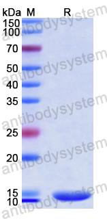 Recombinant Human ANGPTL8 Protein, N-His