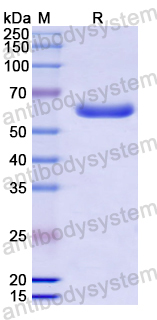 Recombinant Human NPNT Protein, N-His